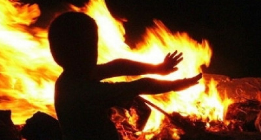 В Домбаровском районе двое детей получили термические ожоги