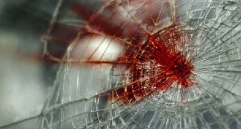 В Оренбурге полиция разыскивает водителя, который сбил пешехода и скрылся