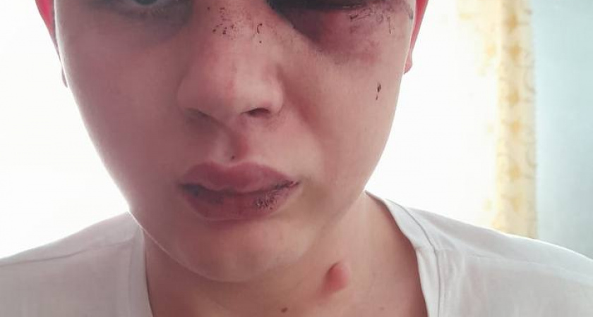 Мама избитого подростка в илецкой школе обратилась к депутату Батурину