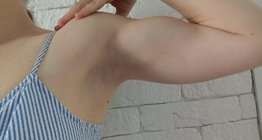 Этот копеечный продукт уберет сильнейшую вонь пота из подмышек - мажьте каждый день