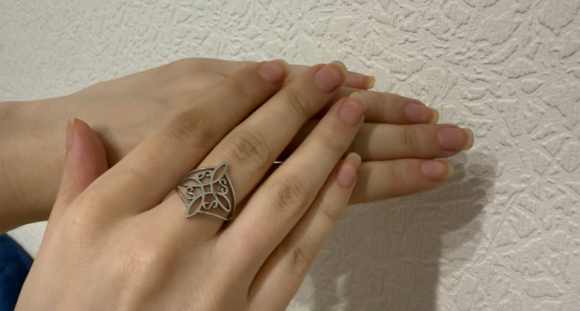 Пигментные пятна: почему появляются и как уберечь кожу весной и летом