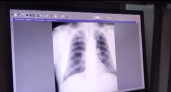 Это может случиться с каждым. В Областном центре зарегистрировано более 200 случаев туберкулеза - ГТРК "Оренбург"